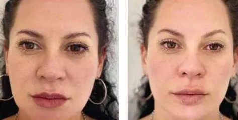 VectorLift, before and after